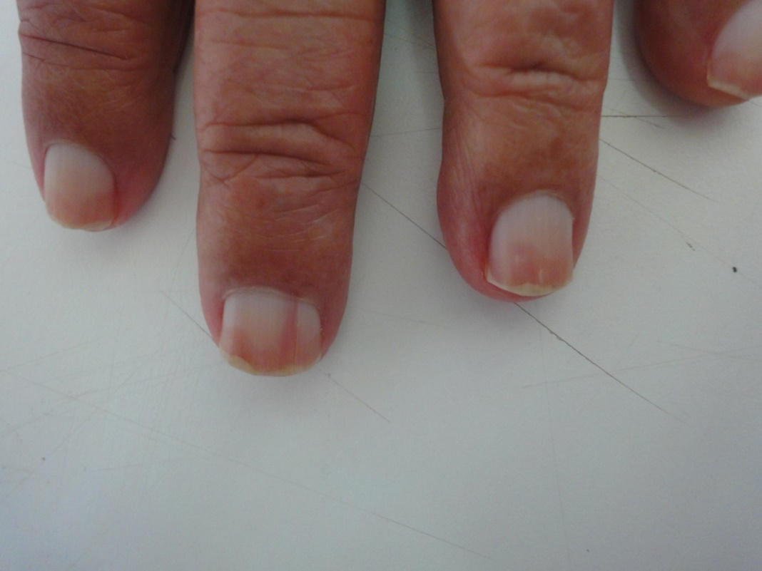 PDF) An Atlas of Nail Disorders, Part 5