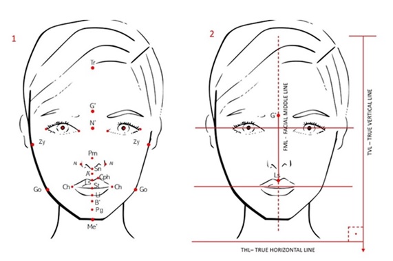 Faciometrics: A Practical Guide for Orofacial Harmonization